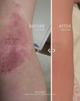 Before and After photos showing a severe rash before and clear skin after labelled with Before Coco Oat and After Coco Oat including a notation that Real Customer Photos shared with permission
