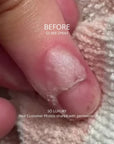 Video showing before and after photos of a wart on a finger that went away with the use of Silver Spray photos includes text Before / After Silver Spray and Só Luxury and Real Customer Photos shared with permission